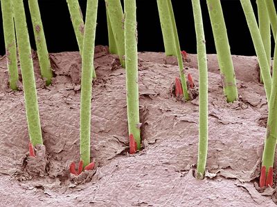 Human eyelashes under magnifcation. Colored scanning electron micrograph (SEM) of human eyelash mites