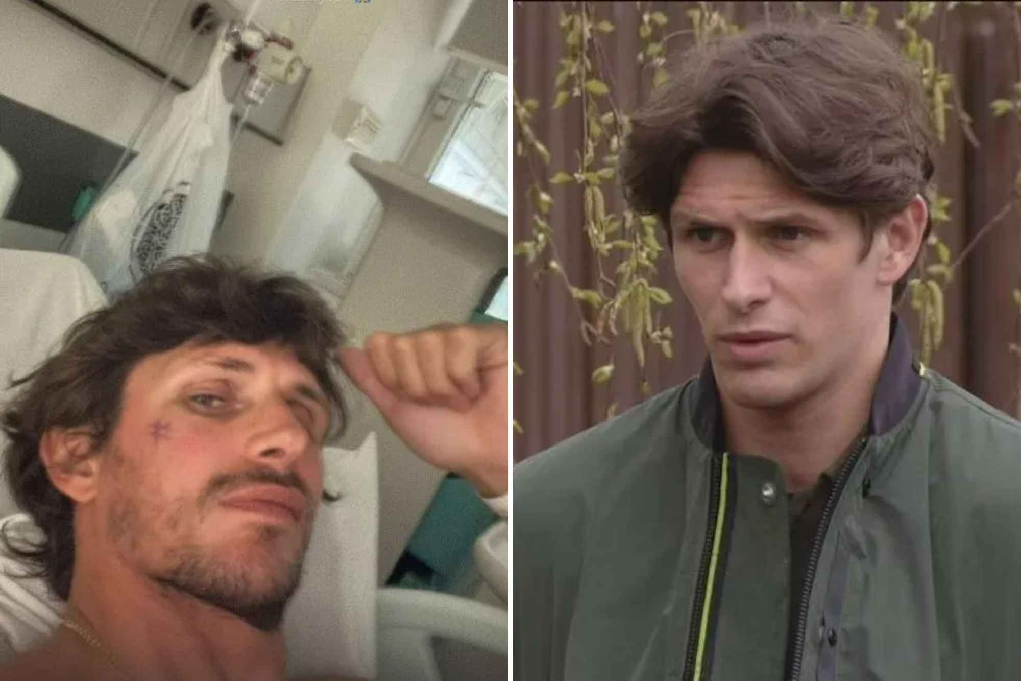 Ex-Towie star Jake Hall sparks concern as he shares photo from hospital bed