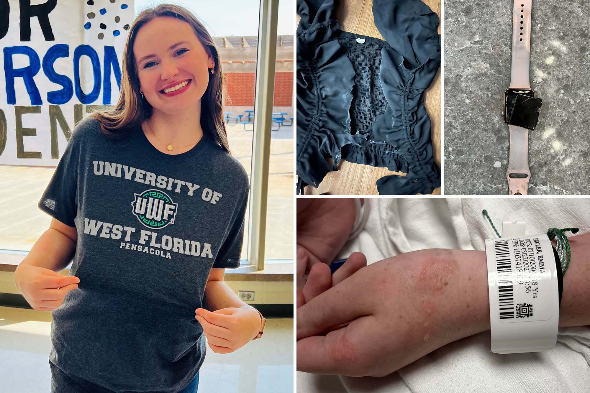 Alabama teen Emma Eggler was struck by lightning on her very first day of classes at the University of West Florida.