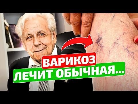 Неумывакин_ Сколько раз я писал, что от варикоза помогает об...