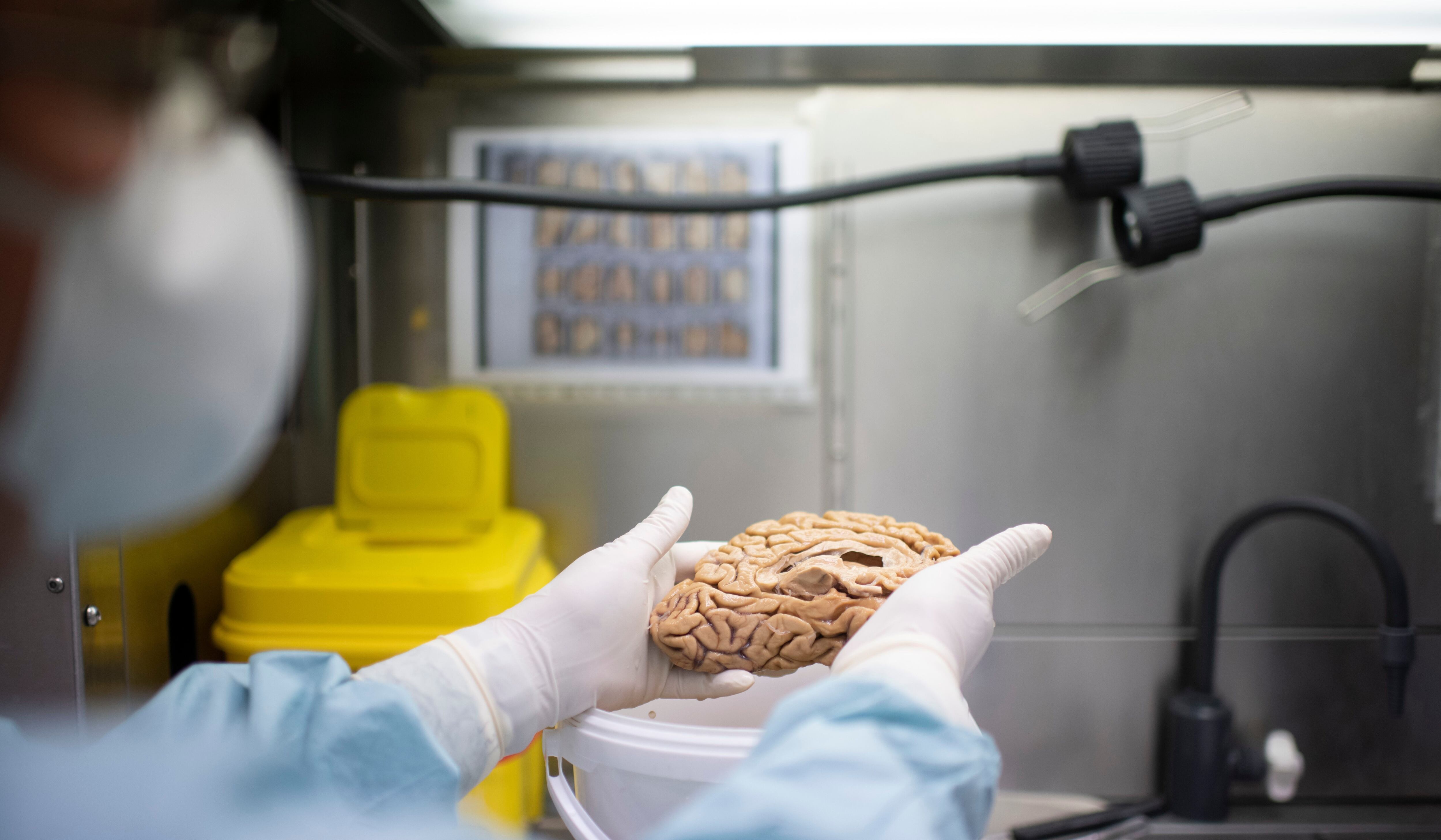 A researcher handles a brain sample.