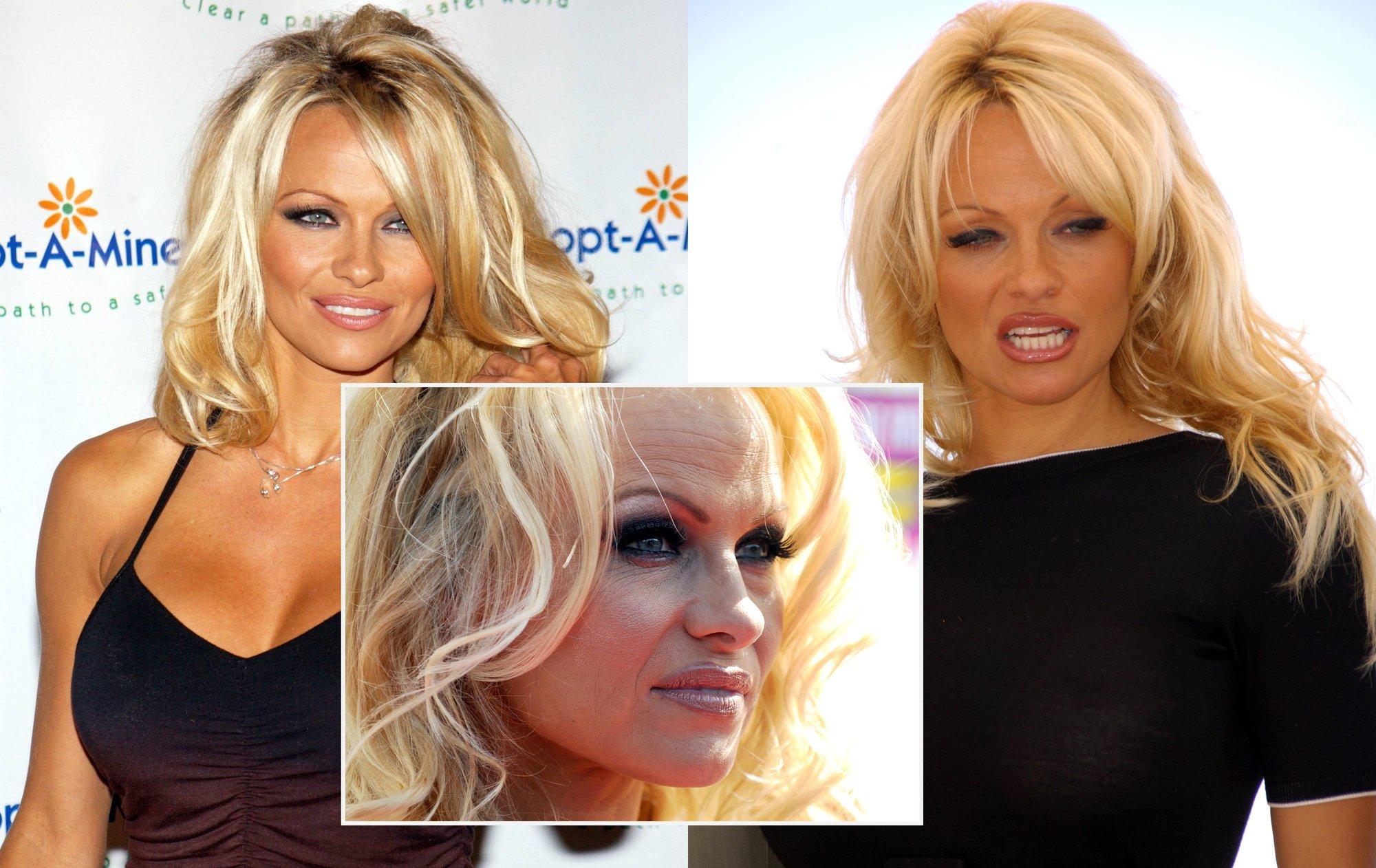 Be makiažo pasirodžiusi Pamela Anderson prabilo apie kitą savo pusę: nemėgstu injekcijų, manęs tokie dalykai neveikia
