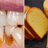या 5 गोष्टी खाऊन तुमचे दात झाले पिवळेधम्मक? किचनमधली ही वस्तू दातांवर रगडायला करा चालू, सेकंदात लख्ख होईल बत्तीशी 