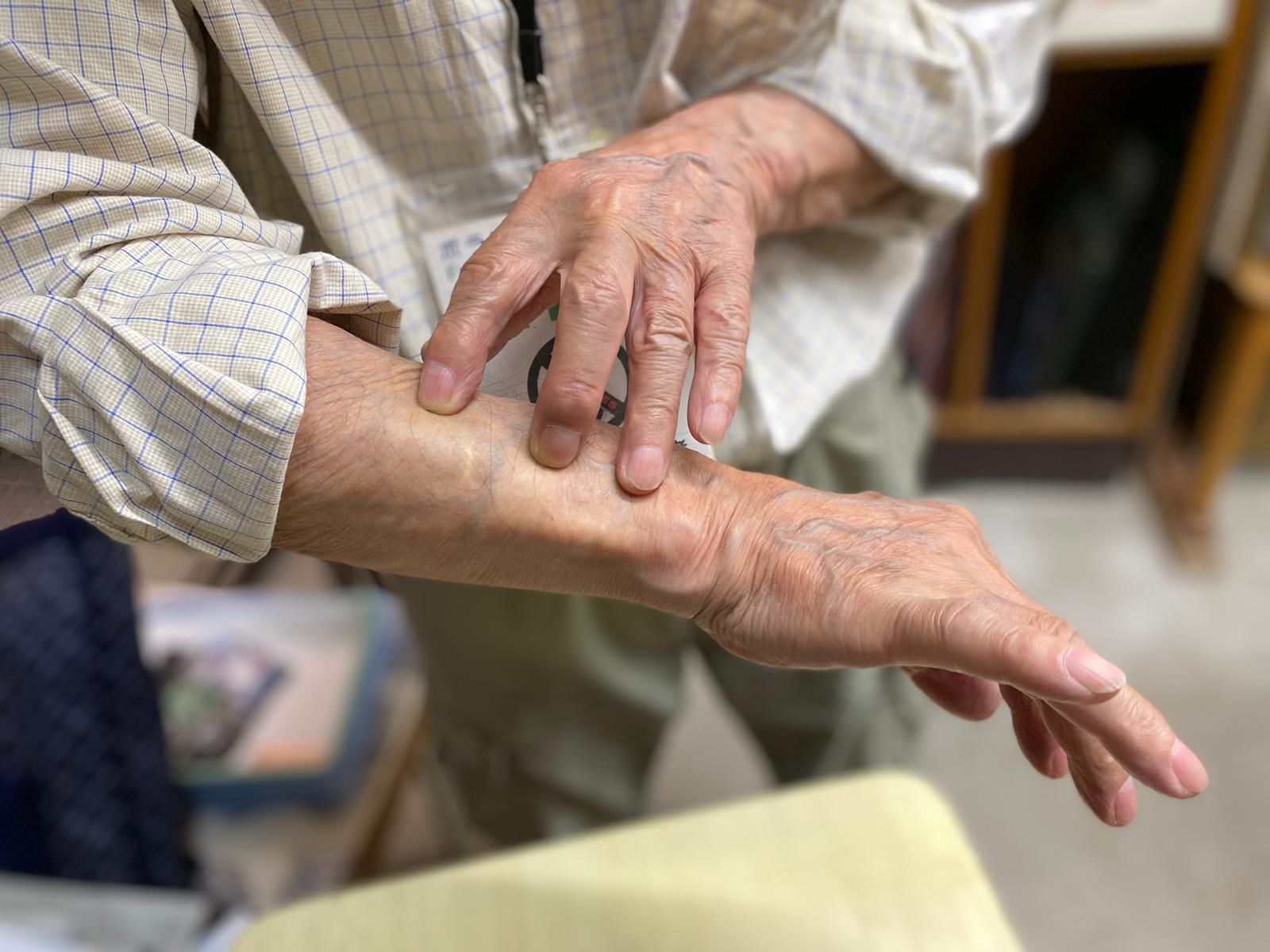 <strong>Painful reminders: </strong>The force of the atomic blast threw Terao -- then aged four -- off his feet and shattered windows. Glass shards peppered Terao, leaving scars all over his body that are visible to this day.