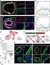 Vascular remodeling causes phenotypic shift among pulmonary artery smooth m