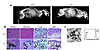 Ahsg deficiency in DBA/2 mice leads to severe ectopic calcification on a no