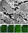 Disruption of the lamin-desmin intermediate filament network in lamin A/C–d