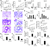 Agonistic anti-CD137 mAb prevents AHR and eosinophilic airway inflammation