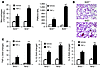 TNF-α stimulus induced greater lung inflammation in Nrf2-deficient mice.