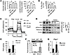 NOTCH reprograms M1 Macs to glucose mitochondrial oxidation through upregul