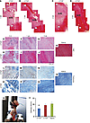 CTGF-enhanced PT healing: H&E in low magnification, high magnification, and