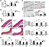 Aortic developmental defects and aberrant aortic remodeling with TAC in Fox