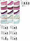 Loss of p53 rescues TAC-induced aortic rupture and SMC apoptosis in Foxe3-d