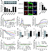 VDAC1 controls mitochondrial calcium release during demyelination.