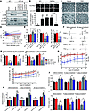 Blocking VDAC1 activity prevents demyelination and improves neuromuscular p