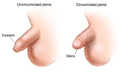 pr7_circumcision (397x239, 17Kb)