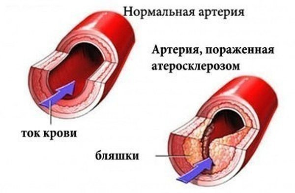 jDB_UltOC0U (600x392, 120Kb)