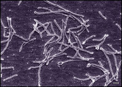 Thermus aquaticus (Deinococcus-Thermus)