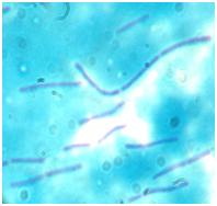 Imagen microscópica Lactobacillus bulgaricus.
