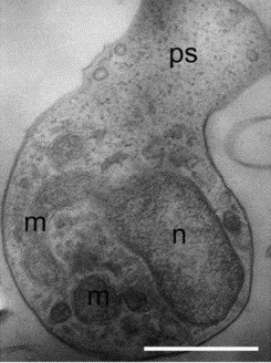 Amoeboaphelidium protococcarum의 육질충 유주자. ps = 위족(pseudopodium), m = 미토콘드리아(mitochondrion), n = 세포핵(nucleus). 눈금 막대: 1 μm.