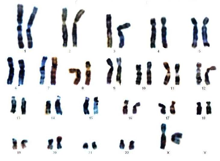 Хромосомный набор человека (женский)