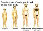 Terminalhårets utveckling med ålder hos män.