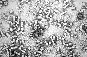 Partículas virais de Orthohepadnavirus