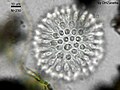 Koloni Sphaeroeca (sekitar 230 dalam bilangan) di bawah mikroskop cahaya.