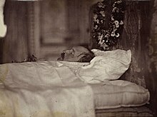 Photographie d'un homme mort. Allongé dans son lit, seule sa tête dépasse.