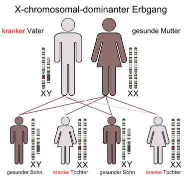 X-chromosomal durch den Vater vererbtes, dominantes Merkmal. Alle Töchter tragen das Merkmal.