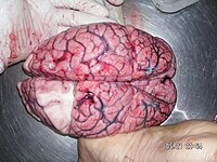 ヒトの大脳。前頭葉の一部が切除された状態。