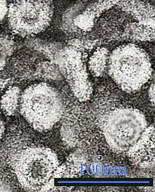 TEM micrograph showing hepatitis B virus virions (with 100 nm scale bar)