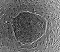 Human embryonic stem cell colony on mouse embryonic fibroblast feeder layer