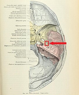 Foro spinoso, messo in evidenza (riquadro rosso) in una sezione trasversa del neurocranio. Medialmente sono visibili anche gli altri fori della grande ala sfenoidea.