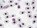 خلايا الدم الحمراء في سلحفاء مُكبرة 1000 مرة.