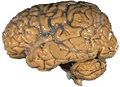 un cerveau humain