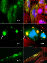 Microscopia de fluorescência de expressão de DNA no Human Wild-Type and P239S Mutant Palladin.