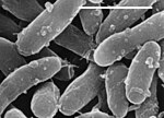 Bacteria - Gemmatimonas aurantiaca (- = 1 Micrometer)