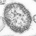麻疹ウイルス (パラミクソウイルス科)