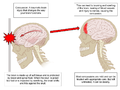 Anatomia della concussione