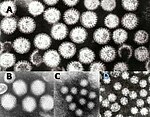 فيروسات التهاب المعدة والأمعاء، حيثُ (A) الفيروس العجلي، (B) الفيروس الغداني، (C) نوروفيروس، (D) الفيروس النجمي. تُظهر الصورة هذه الجزيئات الفيروسية بنفس التكبير بهدف مقارنة الحجم