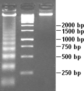 White DNA bands against a dark grey background, resembling the rungs of a ladder