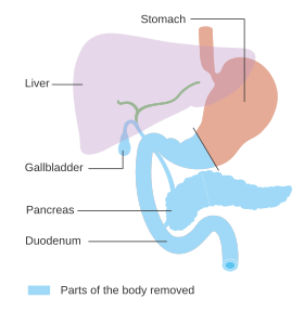 Diagram of the alimentary tract highlighting the gallbladder, pancreas, duodenum and distal stomach