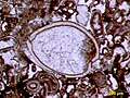 Image 10Articulated ostracod valves in cross-section from the Permian of central Texas; typical thin section view of an ostracod fossil (from Ostracod)