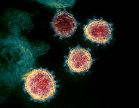 SARS-CoV-2 વાયરસની સૂક્ષ્મદર્શક છબી. વાયરસ ઉપર રહેલાં છોગાં પરથી રોગનું નામ પડ્યું છે.