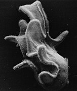 SEM of bipinnaria larva