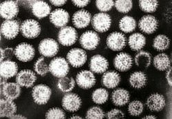 جزيئات متراكمة من الفيروس العجلي، تبدو متماثلة.