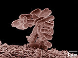 Escherichia Coli