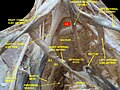 腰神経叢と仙骨神経叢 Deep dissection.Anterior view.