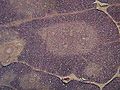 흉선의 소엽을 보여주는 현미경 사진. 피질(자주색이 더 깊은 부분)은 덜 조밀하고 가벼운 골수를 둘러싸고 있다.